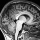 Image for article titled A Neuroscience Experiment You Can Perform On Yourself With Just A Mirror